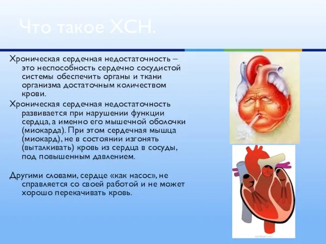 Хроническая сердечная недостаточность – это неспособность сердечно сосудистой системы обеспечить