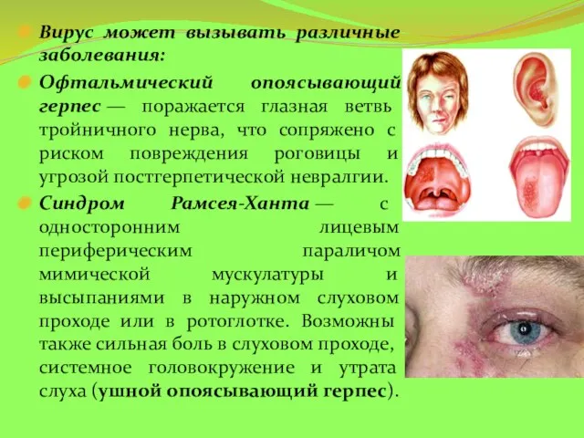 Вирус может вызывать различные заболевания: Офтальмический опоясывающий герпес — поражается