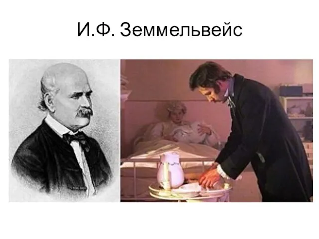 И.Ф. Земмельвейс