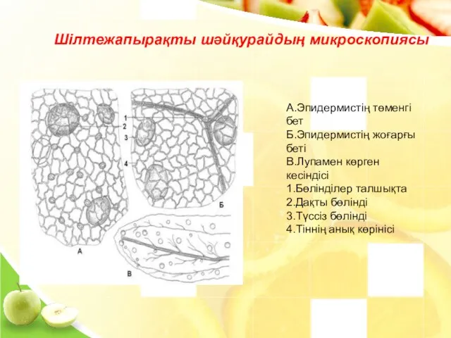 А.Эпидермистің төменгі бет Б.Эпидермистің жоғарғы беті В.Лупамен көрген кесіндісі 1.Бөлінділер