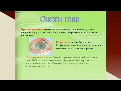 Ожоги глаз Симптомы : резкая боль в глазу, блефароспазм, слезотечение,