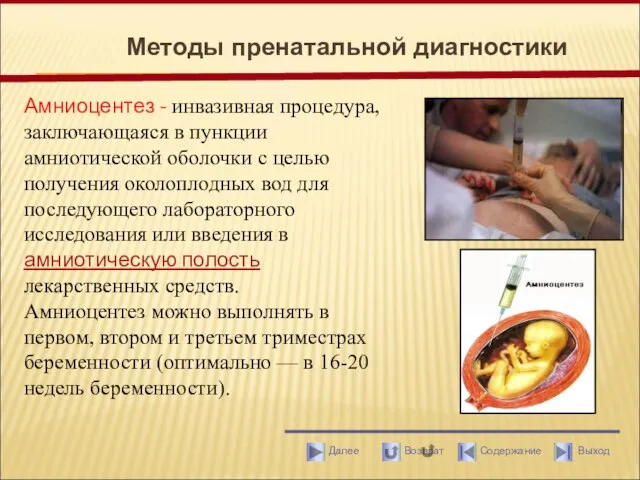 Методы пренатальной диагностики Амниоцентез - инвазивная процедура, заключающаяся в пункции