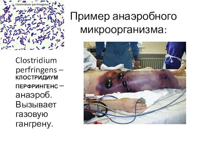 Пример анаэробного микроорганизма: Clostridium perfringens – КЛОСТРИДИУМ ПЕРФРИНГЕНС – анаэроб. Вызывает газовую гангрену.