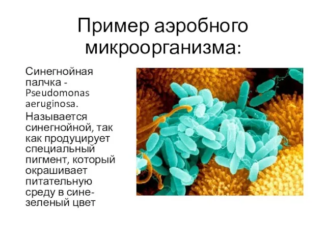 Пример аэробного микроорганизма: Синегнойная палчка - Pseudomonas aeruginosa. Называется синегнойной,