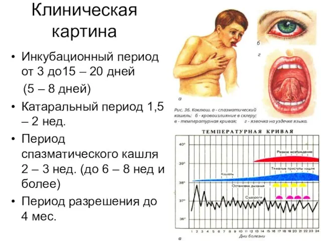 Клиническая картина Инкубационный период от 3 до15 – 20 дней