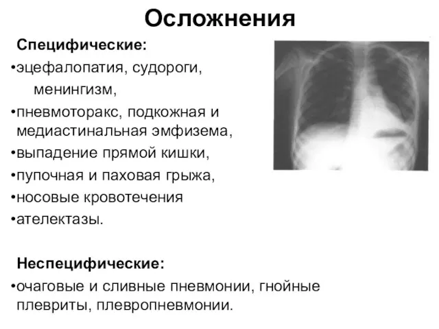 Осложнения Специфические: эцефалопатия, судороги, менингизм, пневмоторакс, подкожная и медиастинальная эмфизема,