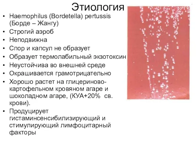 Этиология Haemophilus (Bordetella) pertussis (Борде – Жангу) Строгий аэроб Неподвижна