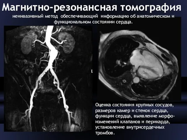 Магнитно-резонансная томография неинвазивный метод обеспечивающий информацию об анатомическом и функциональном