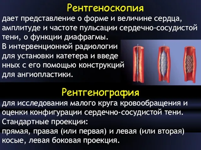 Рентгеноскопия дает представление о форме и величине сердца, амплитуде и