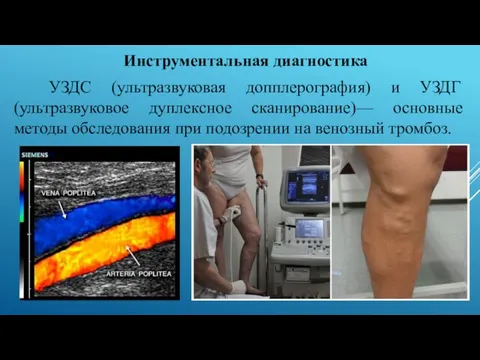 Инструментальная диагностика УЗДС (ультразвуковая допплерография) и УЗДГ (ультразвуковое дуплексное сканирование)—