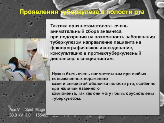 Проявления туберкулеза в полости рта Тактика врача-стоматолога- очень внимательный сбора