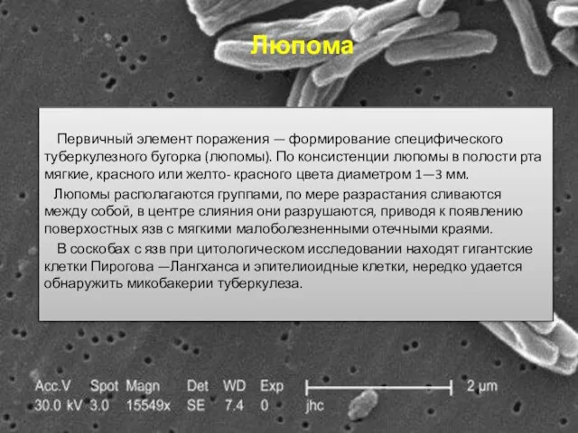 Люпома Первичный элемент поражения — формирование специфического туберкулезного бугорка (люпомы).