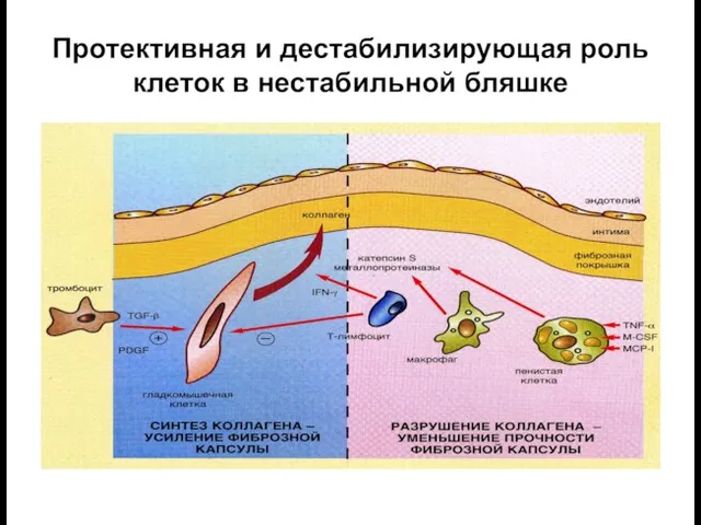 Протективная и дестабилизирующая роль клеток в нестабильной бляшке