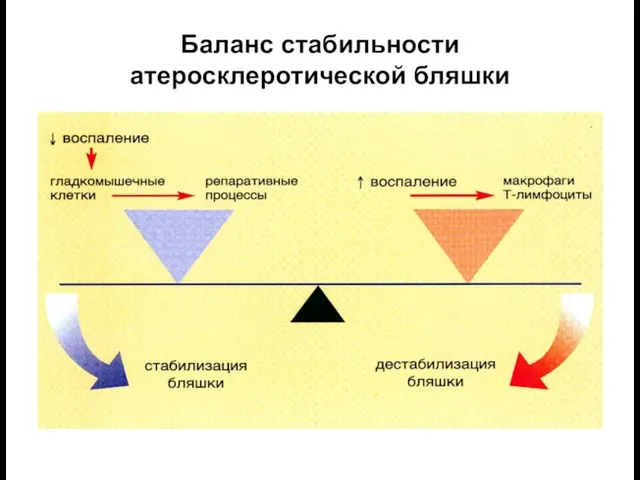 Баланс стабильности атеросклеротической бляшки