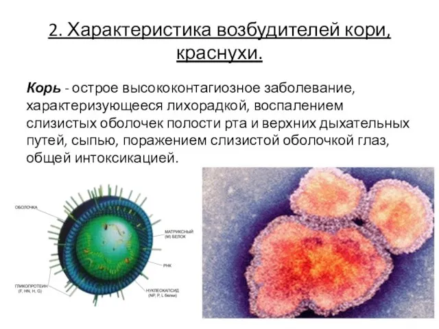 2. Характеристика возбудителей кори, краснухи. Корь - острое высококонтагиозное заболевание,