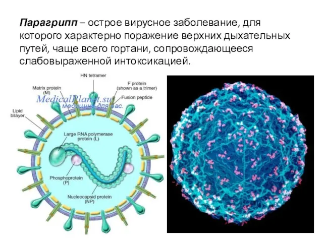 Парагрипп – острое вирусное заболевание, для которого характерно поражение верхних