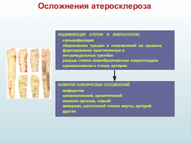 Осложнения атеросклероза