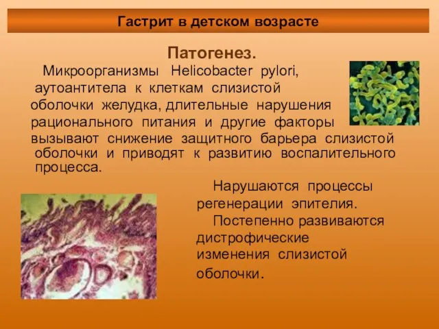Патогенез. Микроорганизмы Helicobacter pylori, аутоантитела к клеткам слизистой оболочки желудка, длительные нарушения рационального