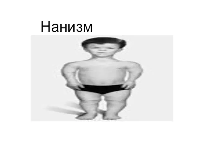 Нанизм