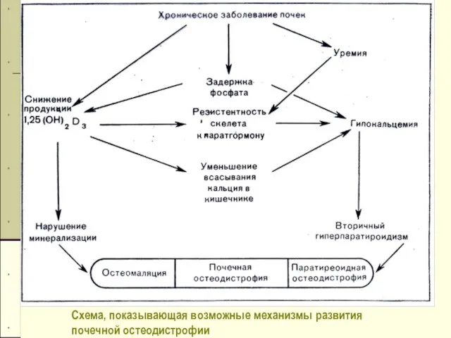 Схема, показывающая возможные механизмы развития почечной остеодистрофии