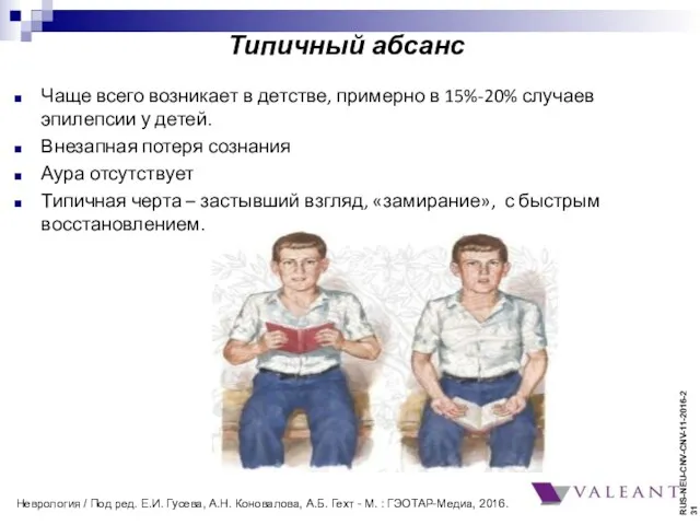 Типичный абсанс Чаще всего возникает в детстве, примерно в 15%-20%