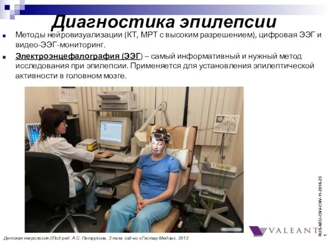 Диагностика эпилепсии Методы нейровизуализации (КТ, МРТ с высоким разрешением), цифровая