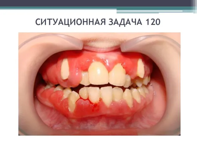 СИТУАЦИОННАЯ ЗАДАЧА 120