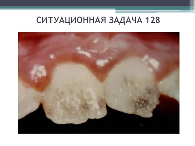 СИТУАЦИОННАЯ ЗАДАЧА 128