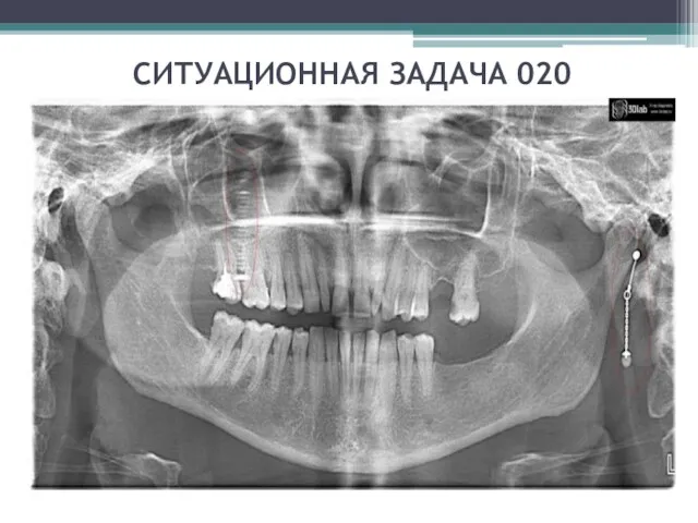 СИТУАЦИОННАЯ ЗАДАЧА 020