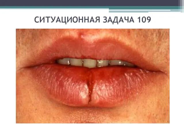 СИТУАЦИОННАЯ ЗАДАЧА 109