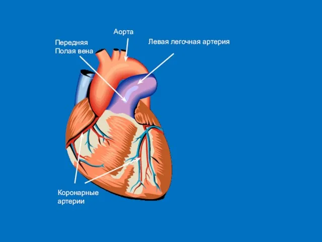 Аорта Левая легочная артерия Коронарные артерии Передняя Полая вена