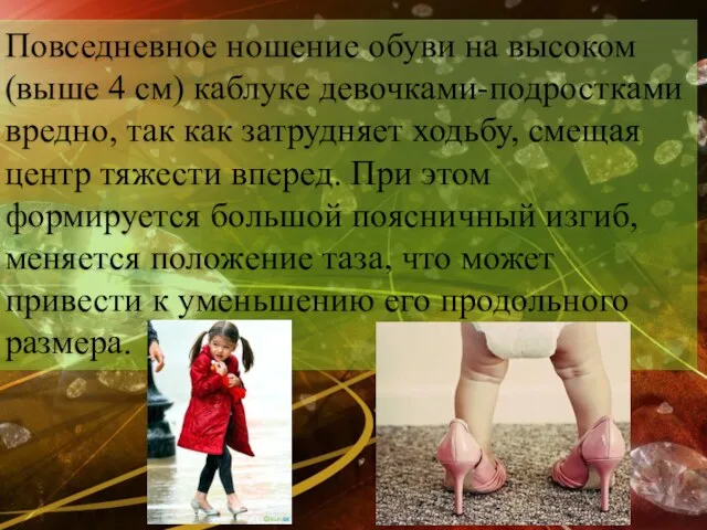 Повседневное ношение обуви на высоком (выше 4 см) каблуке девочками-подростками