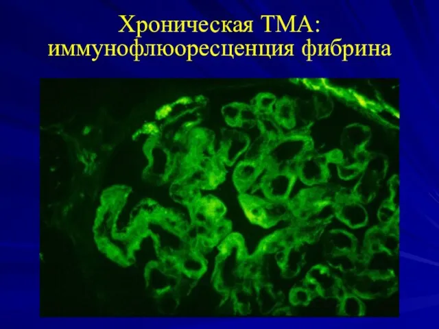 Хроническая ТМА: иммунофлюоресценция фибрина