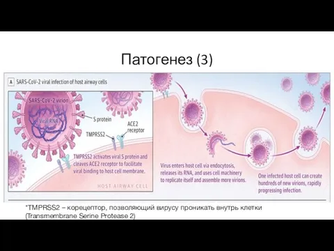 Патогенез (3) *TMPRSS2 – корецептор, позволяющий вирусу проникать внутрь клетки (Transmembrane Serine Protease 2)