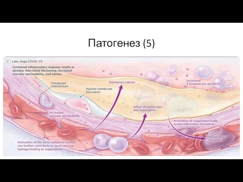 Патогенез (5)