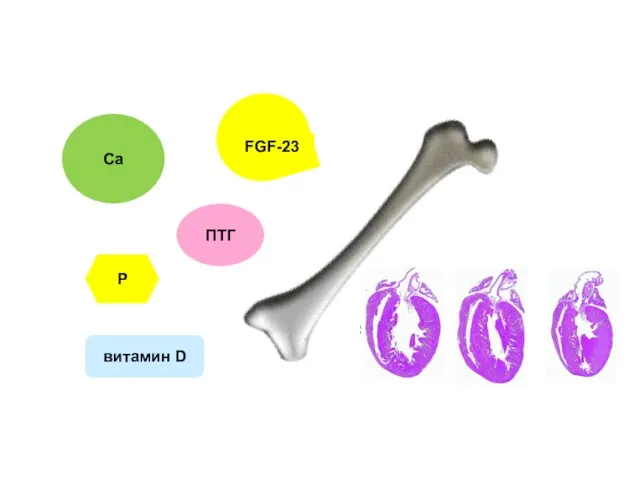 Са витамин D ПТГ Р FGF-23