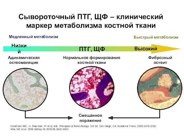 Сывороточный ПТГ, ЩФ – клинический маркер метаболизма костной ткани Goodman