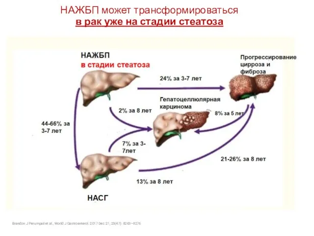 НАЖБП может трансформироваться в рак уже на стадии стеатоза Brandon