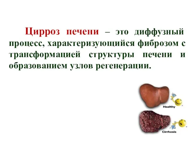 Цирроз печени – это диффузный процесс, характеризующийся фиброзом с трансформацией структуры печени и образованием узлов регенерации.