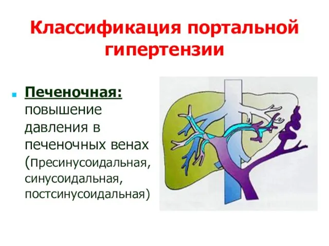 Классификация портальной гипертензии Печеночная: повышение давления в печеночных венах (пресинусоидальная, синусоидальная, постсинусоидальная)