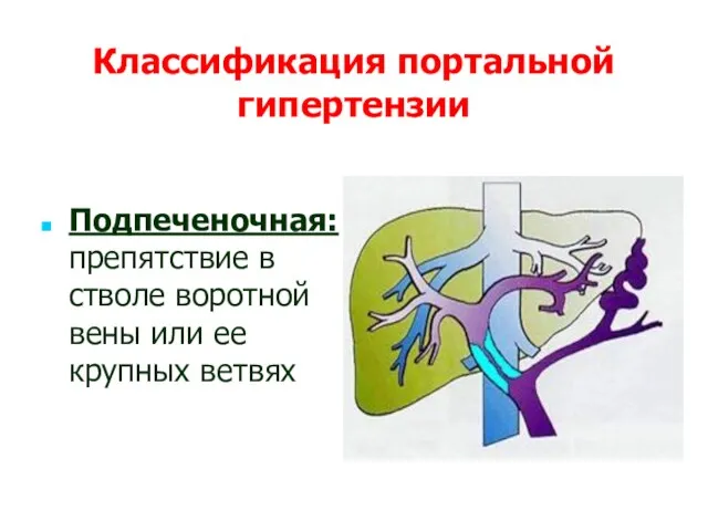 Классификация портальной гипертензии Подпеченочная: препятствие в стволе воротной вены или ее крупных ветвях