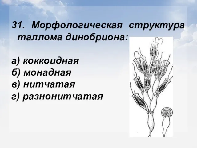 31. Морфологическая структура таллома динобриона: а) коккоидная б) монадная в) нитчатая г) разнонитчатая