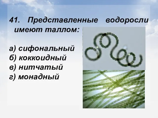 41. Представленные водоросли имеют таллом: а) сифональный б) коккоидный в) нитчатый г) монадный