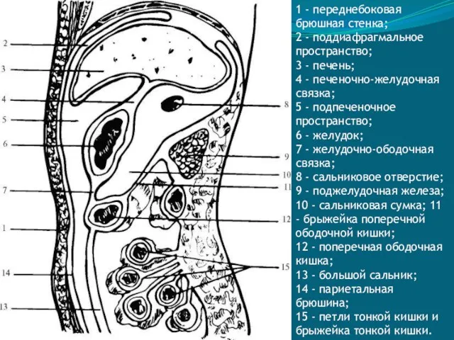 1 - переднебоковая брюшная стенка; 2 - поддиафрагмальное пространство; 3