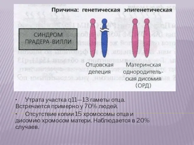 • Утрата участка q11—13 гаметы отца. Встречается примерно у 70%