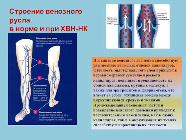 Строение венозного русла в норме и при ХВН-НК Повышение венозного