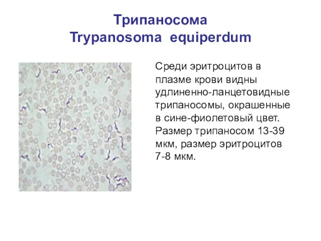 Трипаносома Trypanosoma equiperdum Среди эритроцитов в плазме крови видны удлиненно-ланцетовидные