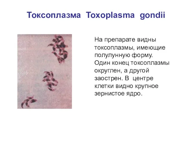 Токсоплазма Toxoplasma gondii На препарате видны токсоплазмы, имеющие полулунную форму.