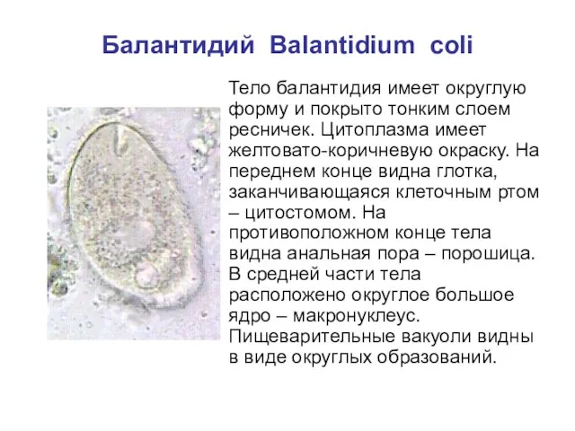 Балантидий Balantidium coli Тело балантидия имеет округлую форму и покрыто