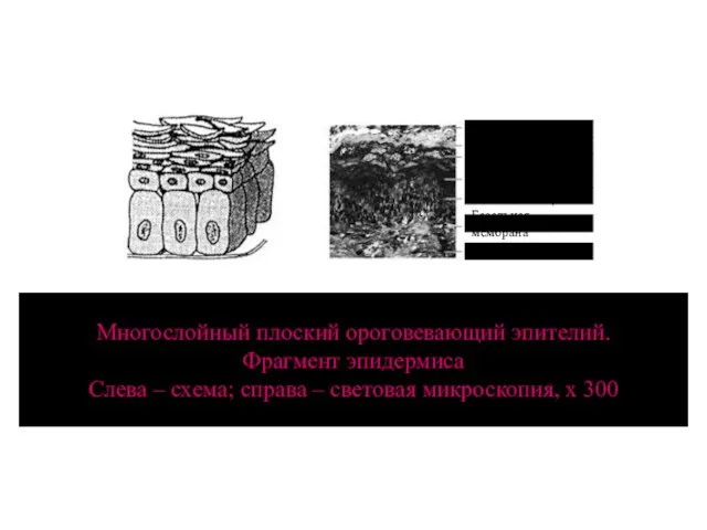 Многослойный плоский ороговевающий эпителий. Фрагмент эпидермиса Слева – схема; справа – световая микроскопия,